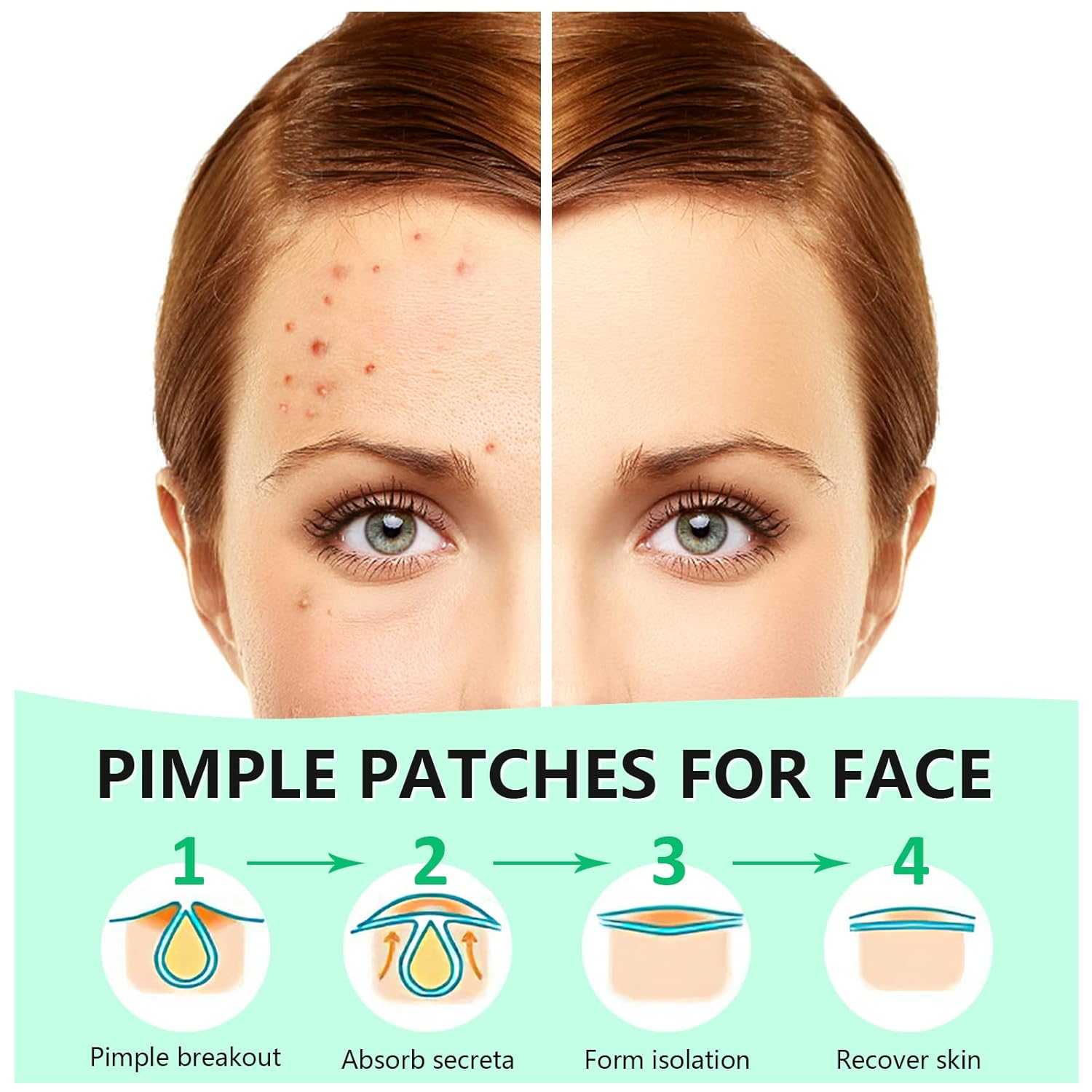 Pimple Patches for Face (120 Counts), Hydrocolloid Acne Patches Zit Patches for Face Acne Spot Treatment Patch Cystic Acne Treatment Stickers Blemish Hydrocolloid Patches for all Skin Type, Plum&Heart